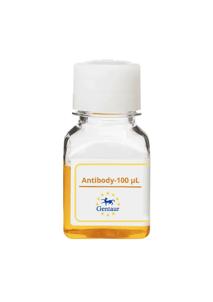 ALKBH7 Antibody   